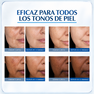 Crema Antimanchas Rostro y Manos